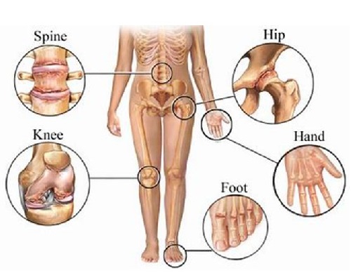 joint structure