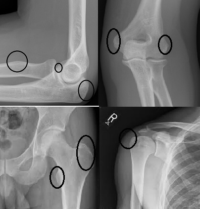 joint structure