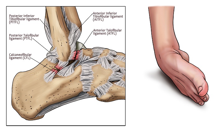 Ligament